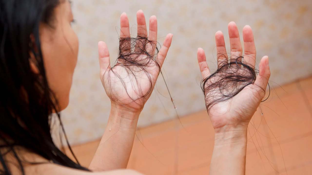 hair-loss-after-bariatric-surgery